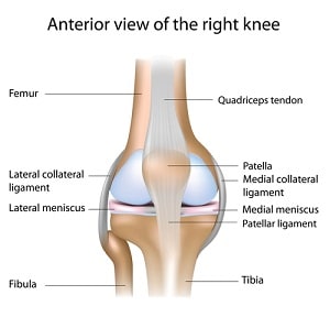 Calculating Knee Injury Settlement Amounts