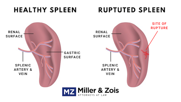 Healthy Spleen