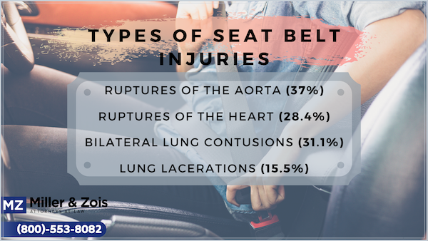 Types of Seat Belt Injuries