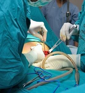 pulmonaryembolism