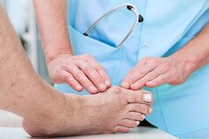 Hammertoe