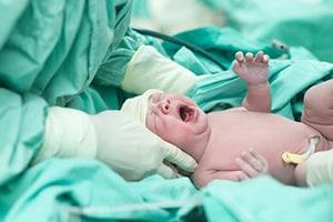 Doctors examining baby