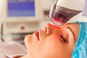 Laser Procedure