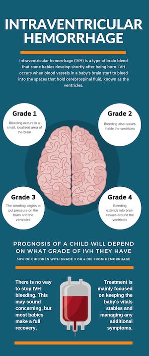 Infographic