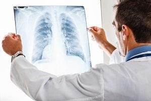 radiology malpractiice in Maryland