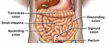 Rectal Cancer Misdiagnosis Lawsuits | Baltimore, Maryland Medical ...