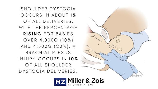 shoulder dystocia statistic