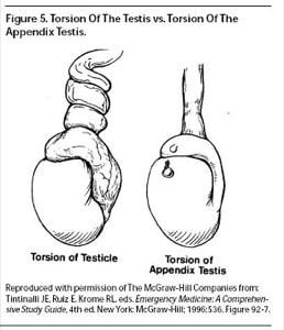 testicularmalpractice