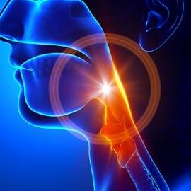 epiglottitis malpractice