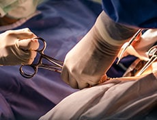 Classic cesarean section in the operating theater