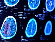 X-ray film of the brain computed tomography