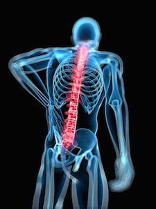 Annular Tear Injury Claims