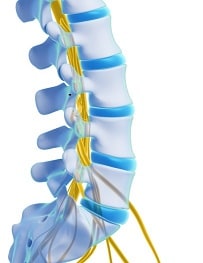 degenerative disc