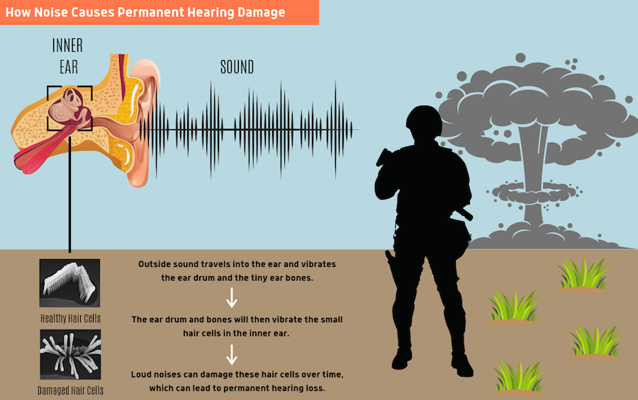 Hearing Loss Infographic