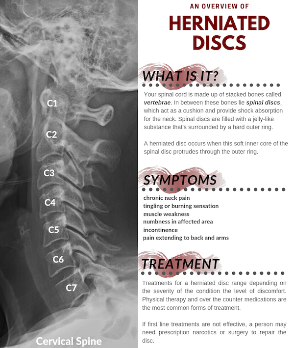 Herniated Disc Settlement Infographic