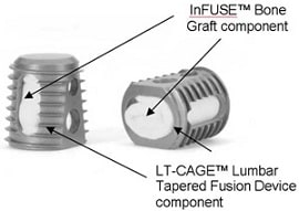 infuselawsuit