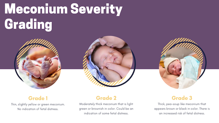 Meconium Severity Grading Infographic
