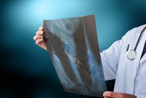 er misdiagnosis