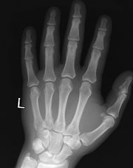 X ray