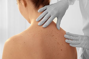 Doctor Treating Rash
