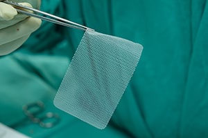 Surgical C-Qur Hernia Mesh