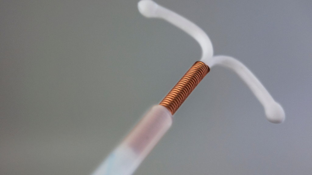 Paragard IUD Lawsuit Lawyer January 2025 Update
