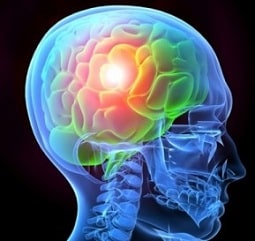 Brain Injuries